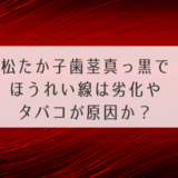 松たか子歯茎真っ黒